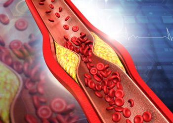 Araştırma: Yüksek seviyede kolesterol demansa yol açabiliyor