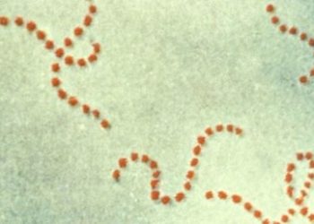 İngiltere’de bakteri 12 can aldı