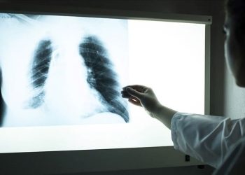 Verem, 2021’de Covid-19’dan sonra dünyada en fazla ölüme yol açan bulaşıcı hastalık oldu