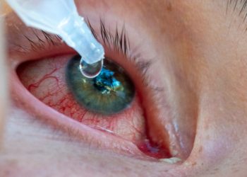 Pakistan’da bulaşıcı ‘kırmızı göz’ hastalığına yakalananların sayısı 86 bini geçti