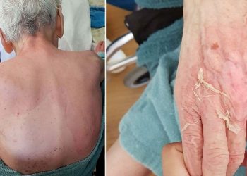 Bakımevinde şüpheli ölüm  | Nadir hastalık denildi, Adli Tıp raporu çalışanları yalanladı