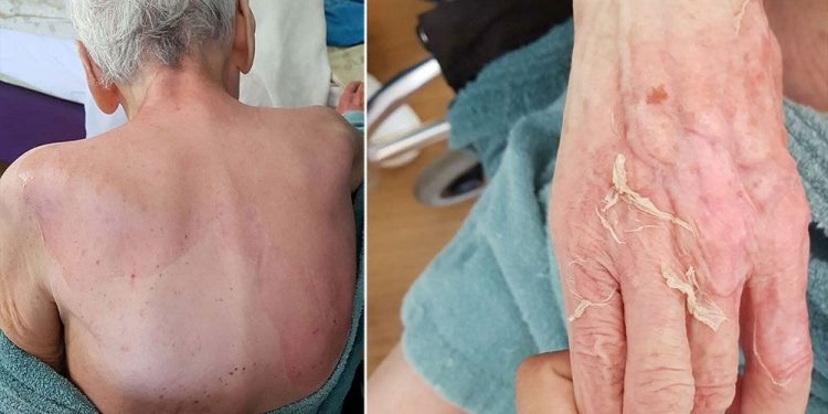 Bakımevinde şüpheli ölüm | Nadir hastalık denildi, Adli Tıp raporu çalışanları yalanladı